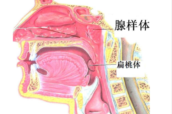 鼻咽部腺样体图片